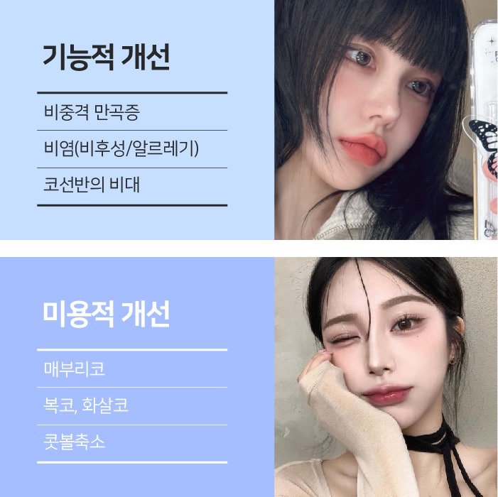 환절기로 인한 비염증상 기능코성형을 고려한다면