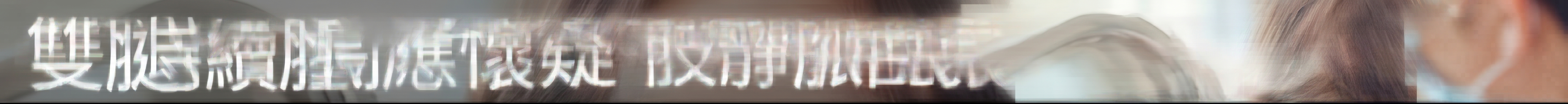 西面雙眼皮手術做得好的地方 雙眼皮手術與上眼瞼手術有何不同？ 사진 13