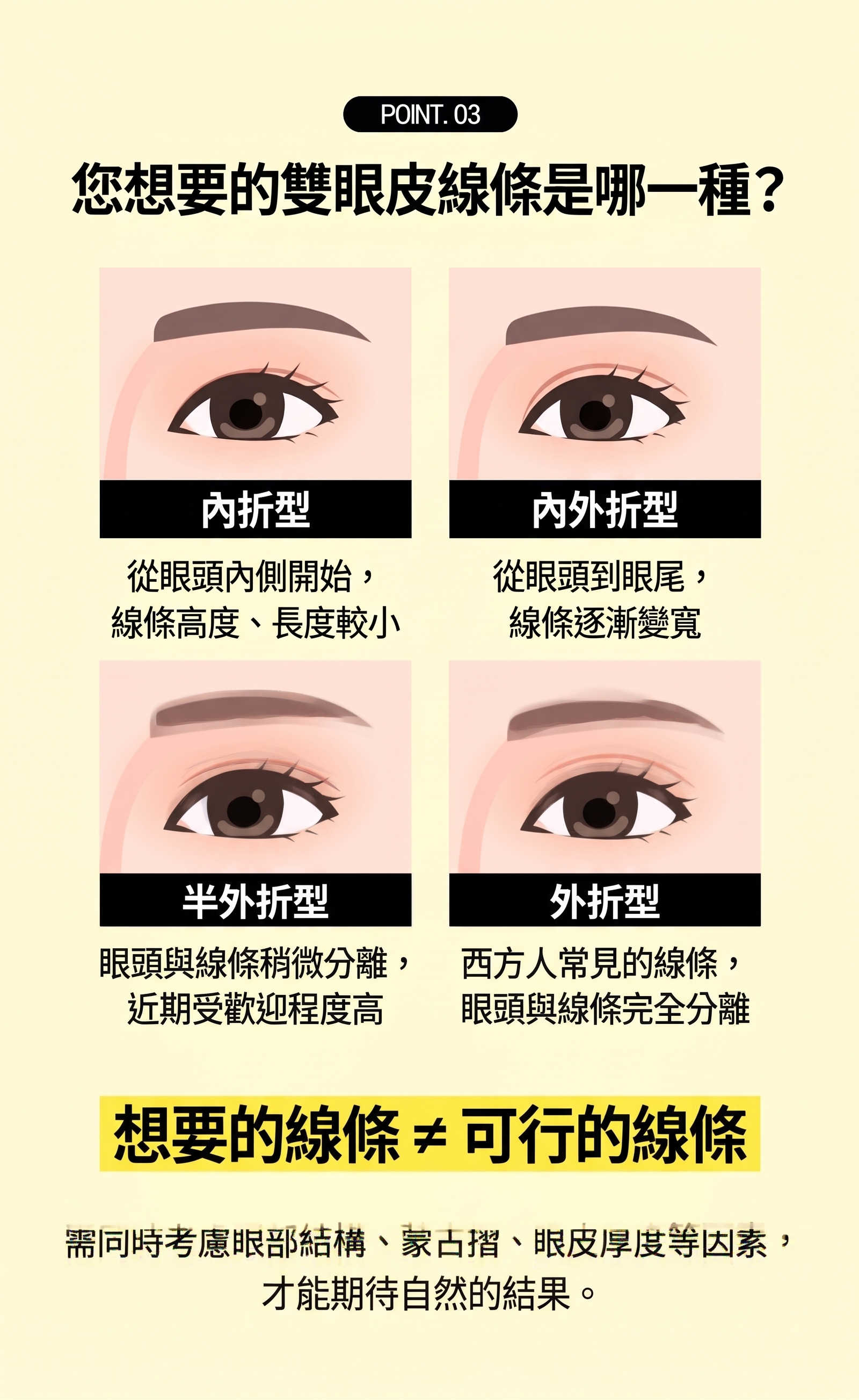 釜山眼部整形，如何找到適合自己的手術方法 사진 6