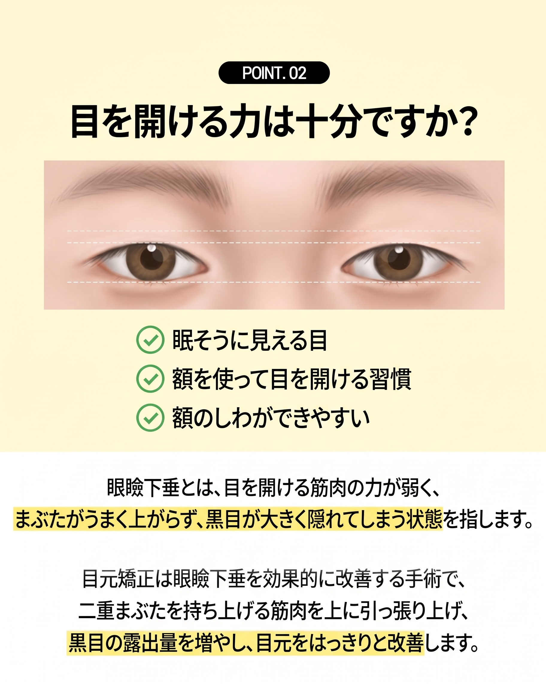 釜山二重まぶた整形、自分の目に合った手術法を見つける方法 사진 5
