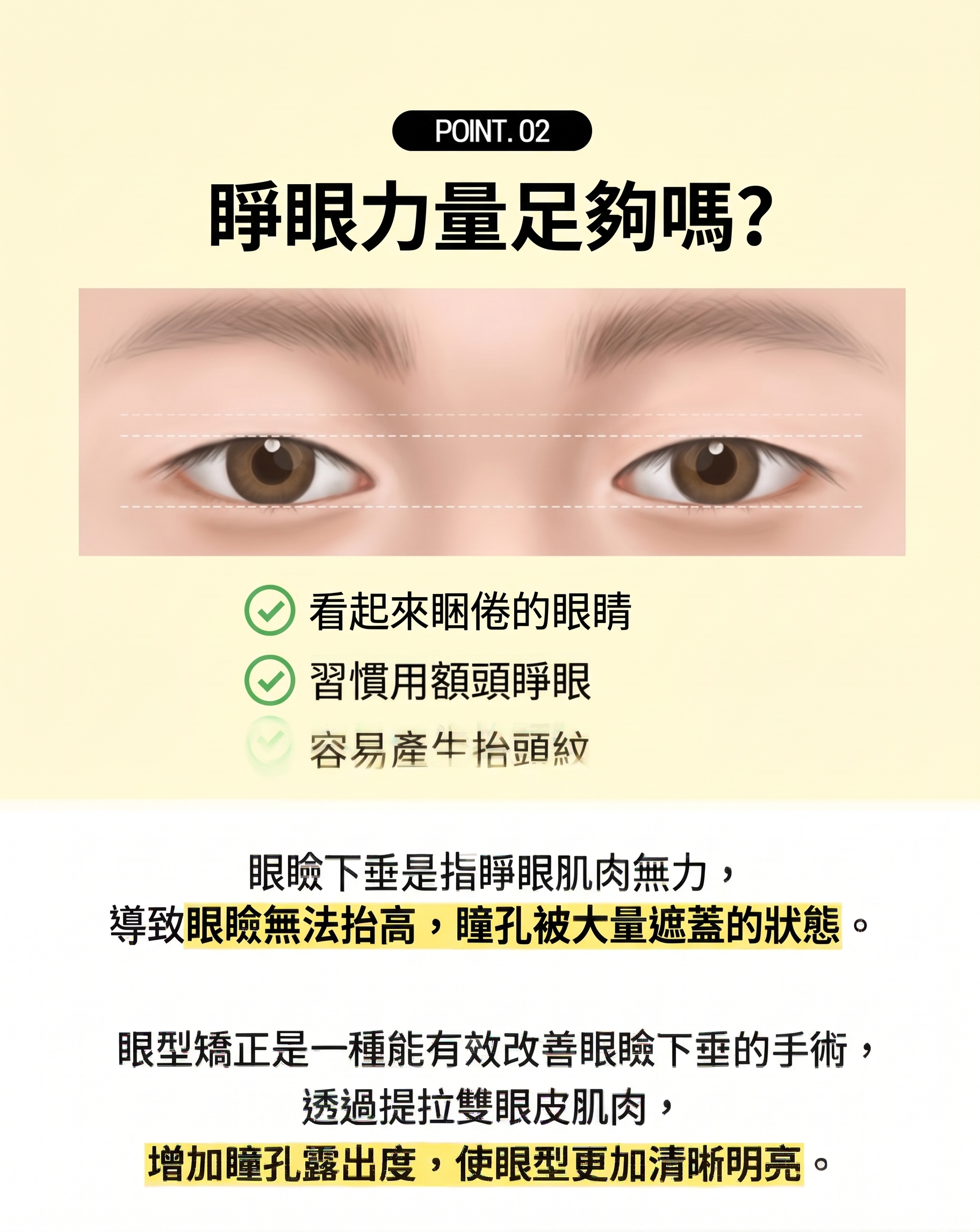 釜山眼部整形，如何找到適合自己的手術方法 사진 5