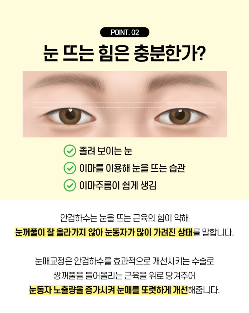 부산눈성형, 내 눈에 맞는 수술법 찾는 방법 사진 5