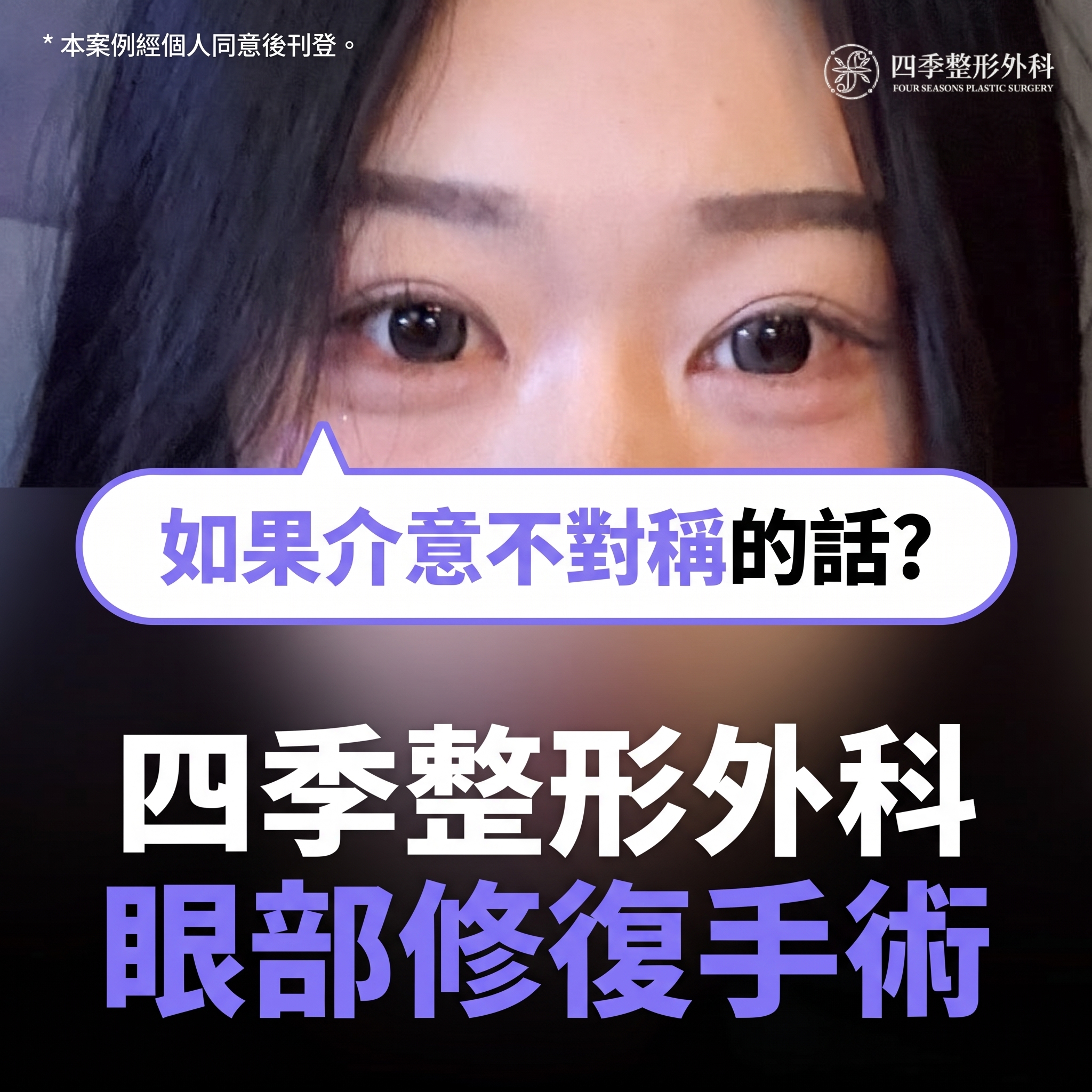 西面雙眼皮修復手術：重新為我量身打造專屬眼型的全過程