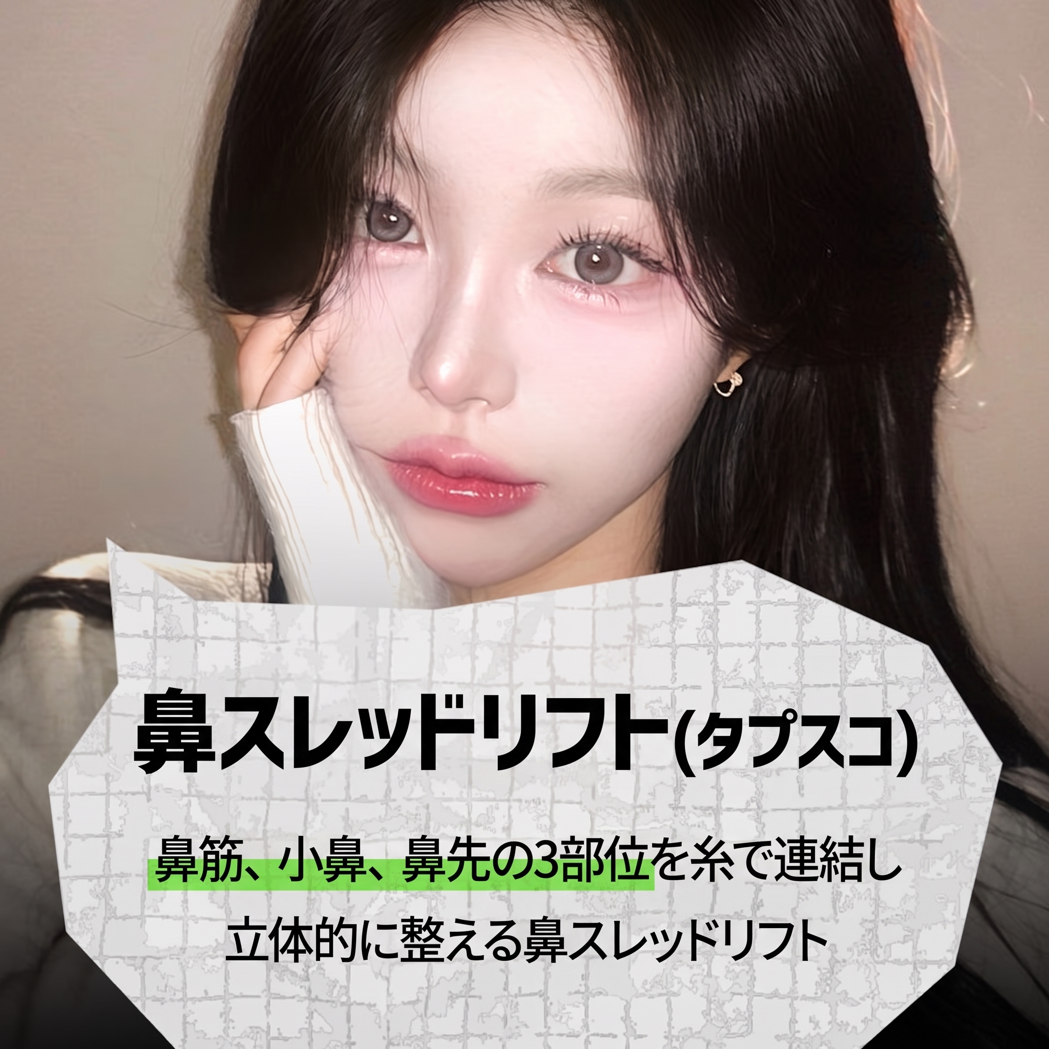 釜山鼻スレッドリフト:切開なしで鼻筋や小鼻を改善できる? 사진 2