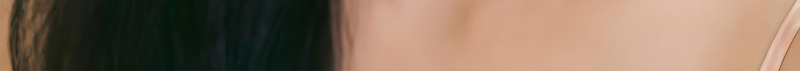 부산코실리프팅 비절개로 콧대,콧볼을 개선시킬 수 없을까? 사진 20