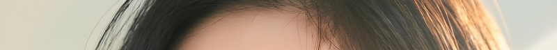 부산코실리프팅 비절개로 콧대,콧볼을 개선시킬 수 없을까? 사진 10