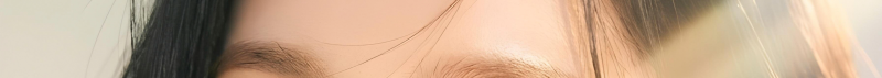부산코실리프팅 비절개로 콧대,콧볼을 개선시킬 수 없을까? 사진 12