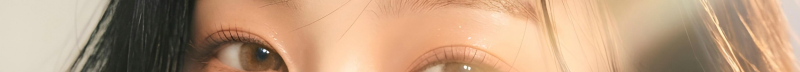 부산코실리프팅 비절개로 콧대,콧볼을 개선시킬 수 없을까? 사진 13