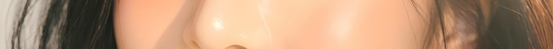 부산코실리프팅 비절개로 콧대,콧볼을 개선시킬 수 없을까? 사진 15