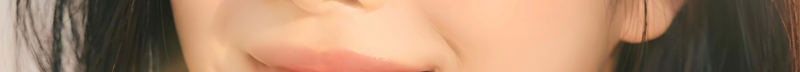 부산코실리프팅 비절개로 콧대,콧볼을 개선시킬 수 없을까? 사진 16