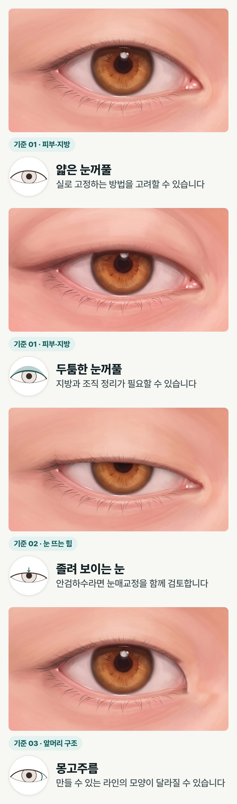 부산쌍수, 원하는 라인보다 먼저 확인할 세 가지 사진 3