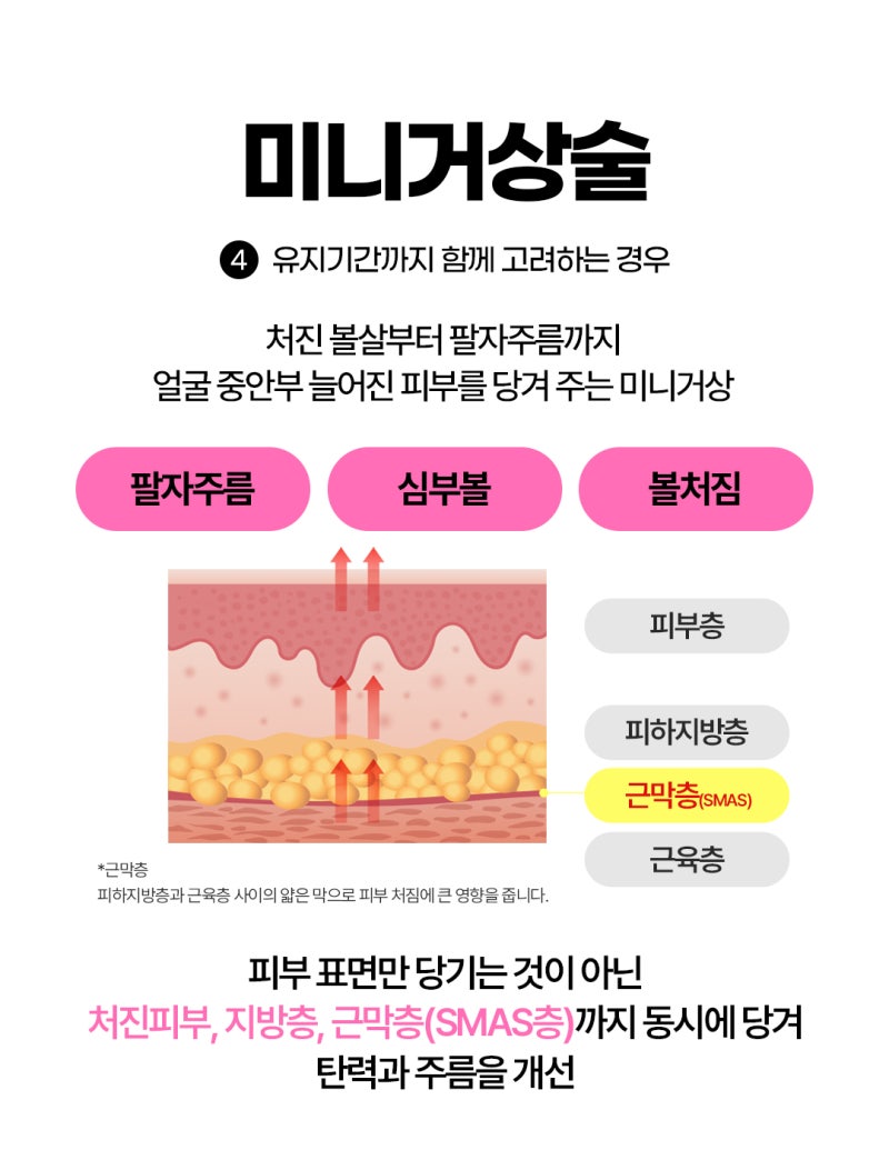 피부 고민 부위별 맞춤 리프팅 선택법 사진 8