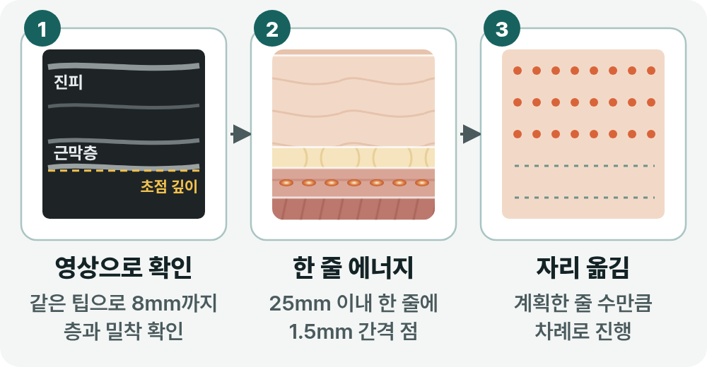 부산울써마지 초음파와 고주파, 피부 속 닿는 깊이가 다른 이유