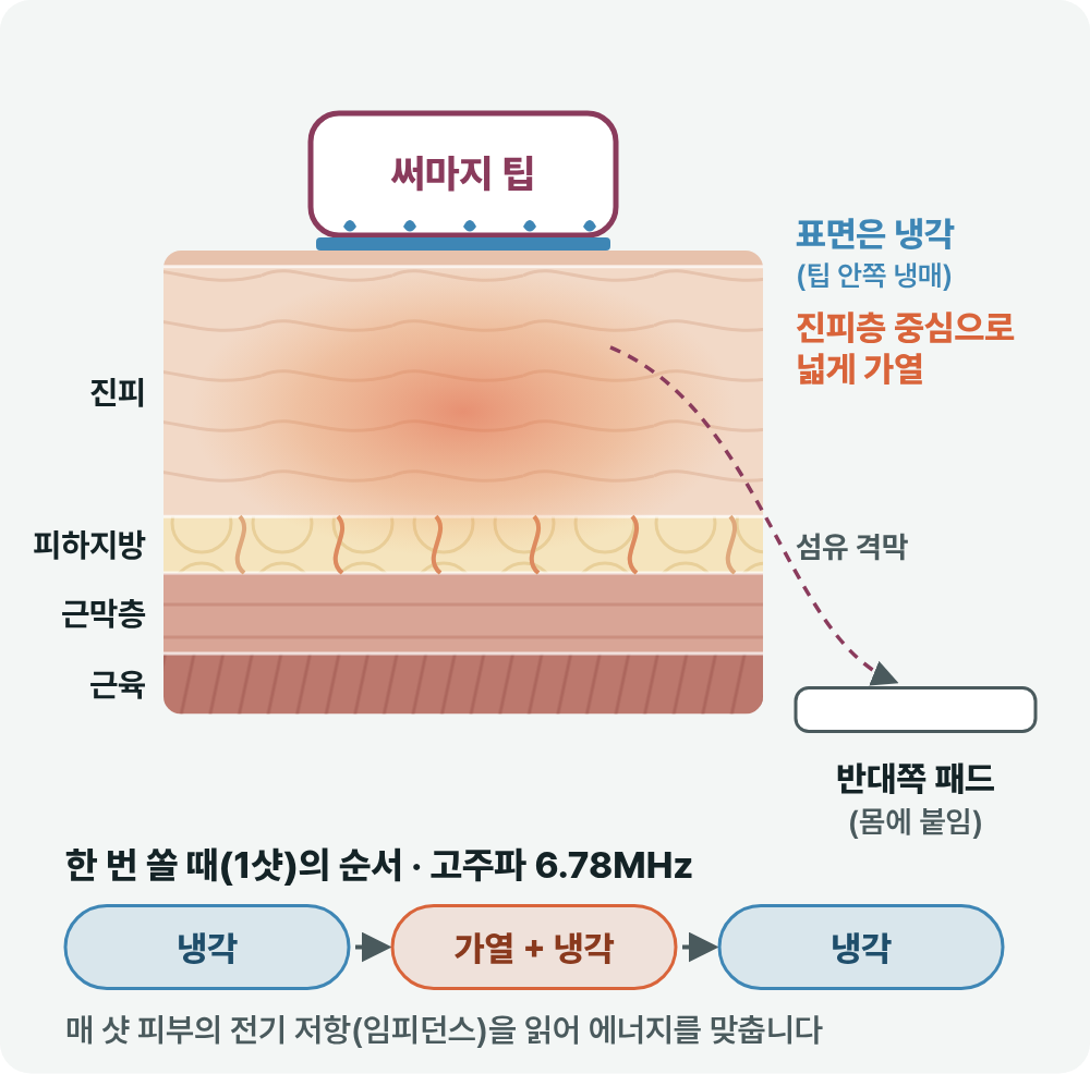 부산울써마지 초음파와 고주파, 피부 속 닿는 깊이가 다른 이유 사진 7